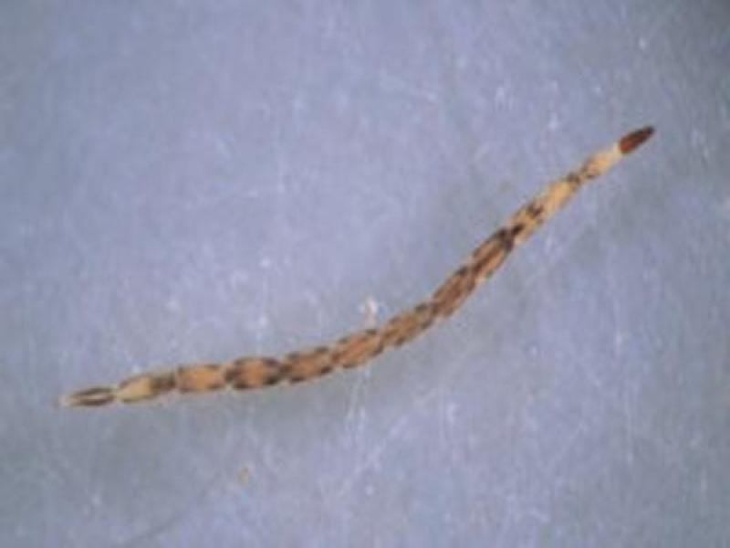 Biting Midge Larvae (Diptera)