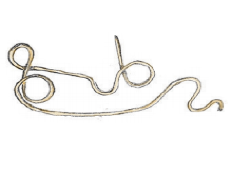 Gordian worms