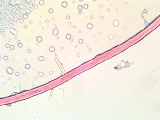 Slides photographed by Thomas Harper. Not sure what this is - Plant Matter?