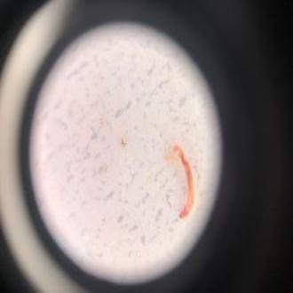 blood worm under microscope x60 mag